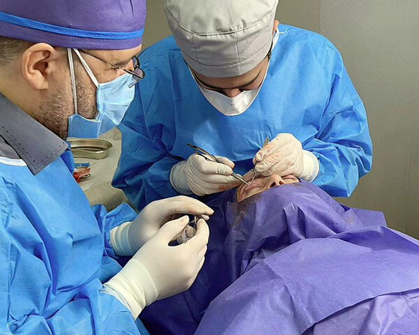 about-dr-hamed-abbasi-4 Dr hamed Abbasi Blepharoplasty